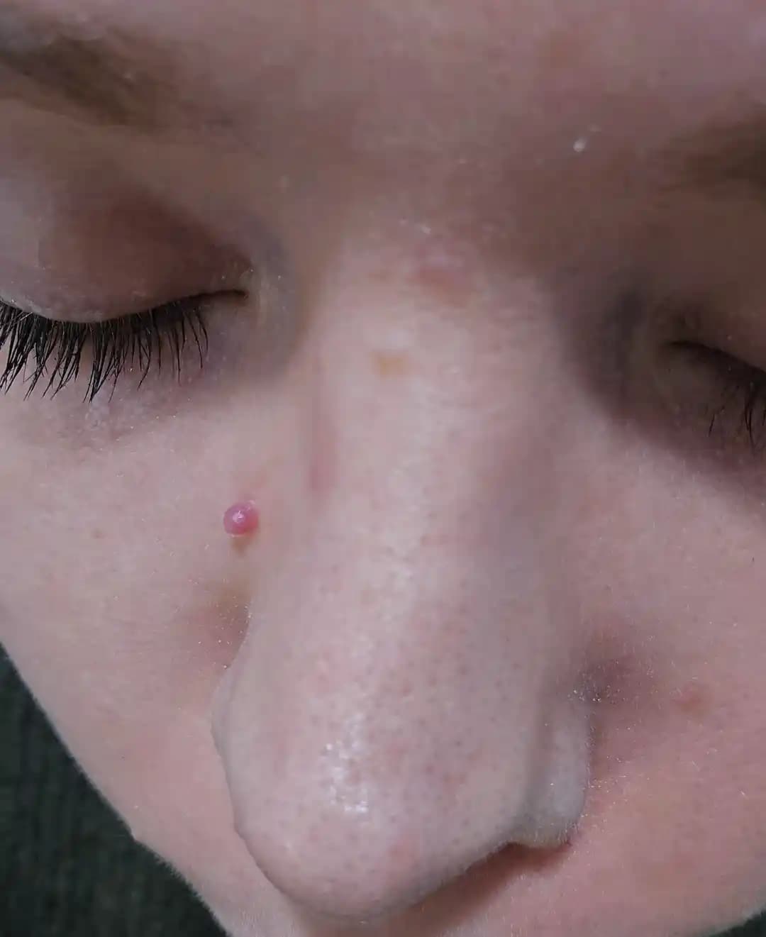 30 Yaş Sonrası Ciltte Meydana Gelen Değişiklikler ve Benlerin Yönetimi Hakkında Bilgiler