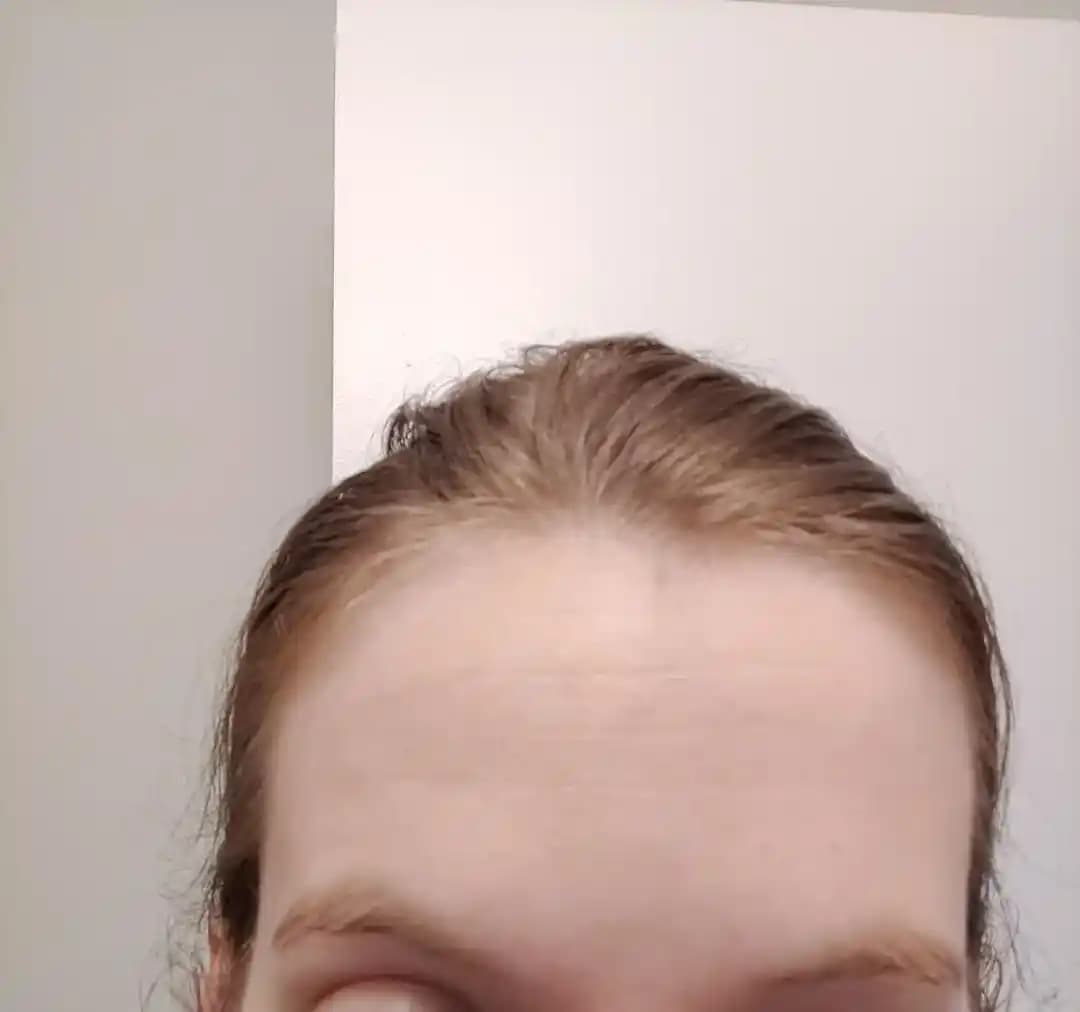 Alın Çizgilerinin Azaltılmasında Etkili Cilt Bakım Yöntemleri ve Ürün İncelemesi