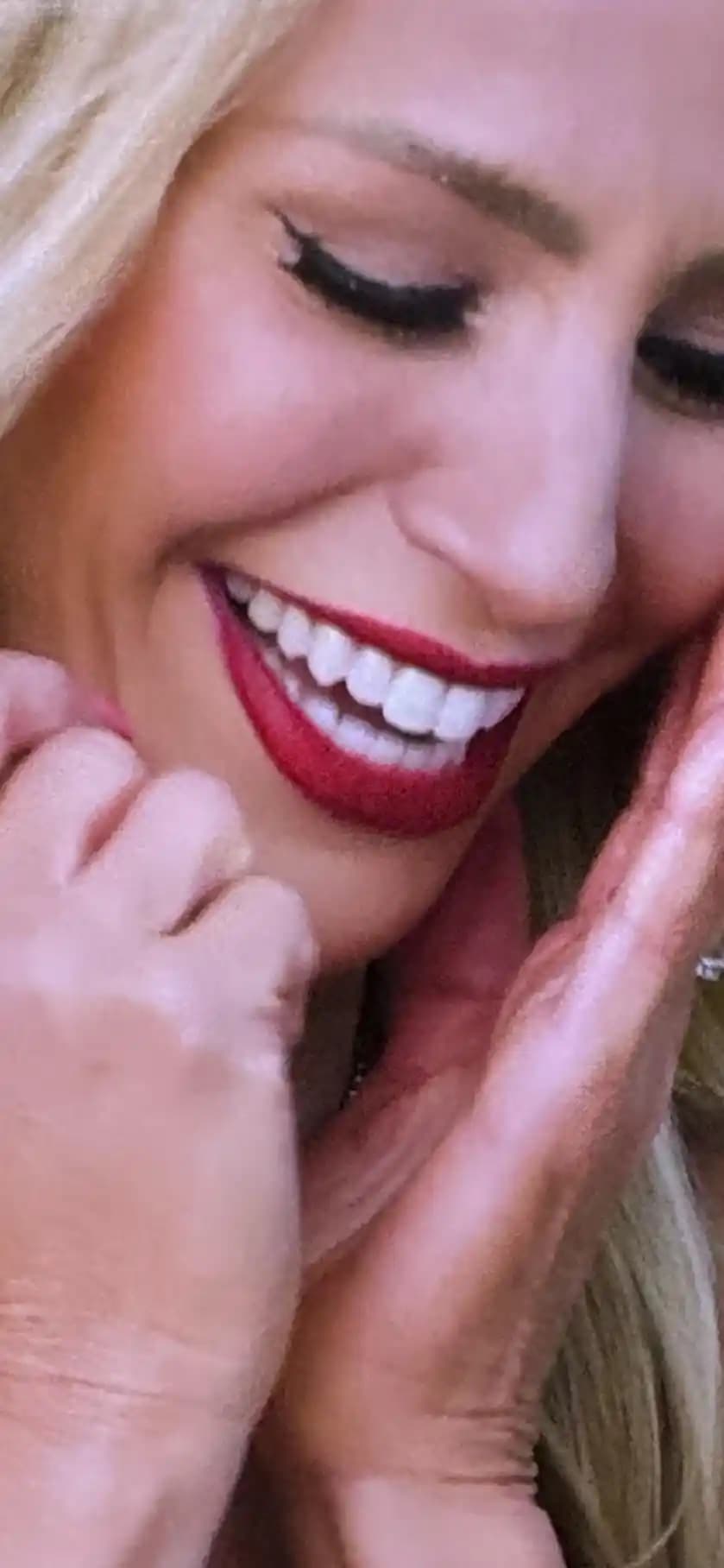 Dişlerin Aşırı Beyaz Görünmesinin Nedenleri ve Uygulanan Yöntemler