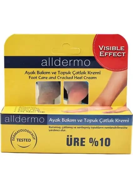 Alldermo Ayak Topuk Bakım Kremi: Doğal İçeriklerle Çok Yönlü Ayak Bakımı Çözümü
