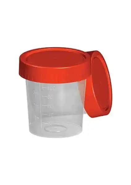 Aromel Steril İdrar Numune Kabı: Güvenilir ve Pratik Laboratuvar Çözümü