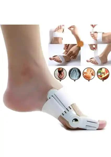 Baş Parmak Kemik Düzeltici ve Gece Ateli ile Halluks Valgus Rahatsızlığını Hafifletin