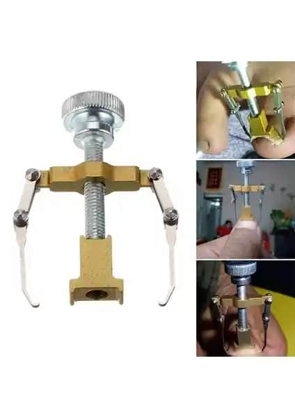 Batık Tırnak Problemlerine Pratik ve Güvenli Çözüm Sunan Tırnak Düzeltme Aleti