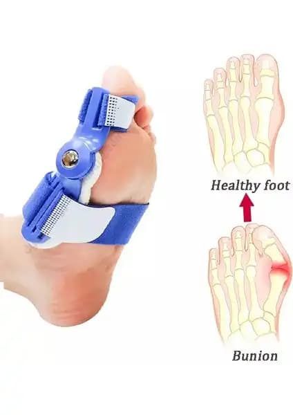 Silimo Gece Ateli Hallux Düzeltici Ayak Baş Parmak Kemiği Sağlığı İçin Etkili Çözüm
