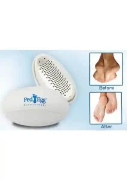 Sin@rasta Ped Egg Ayak Rendesi: Etkili ve Pratik Ayak Bakım Çözümü