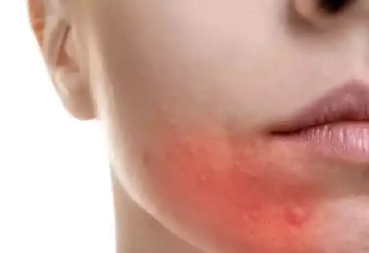 Farklı Yüz Kızarıklıkları İçin Uygun Allık Tonları ve Uygulama Yöntemleri