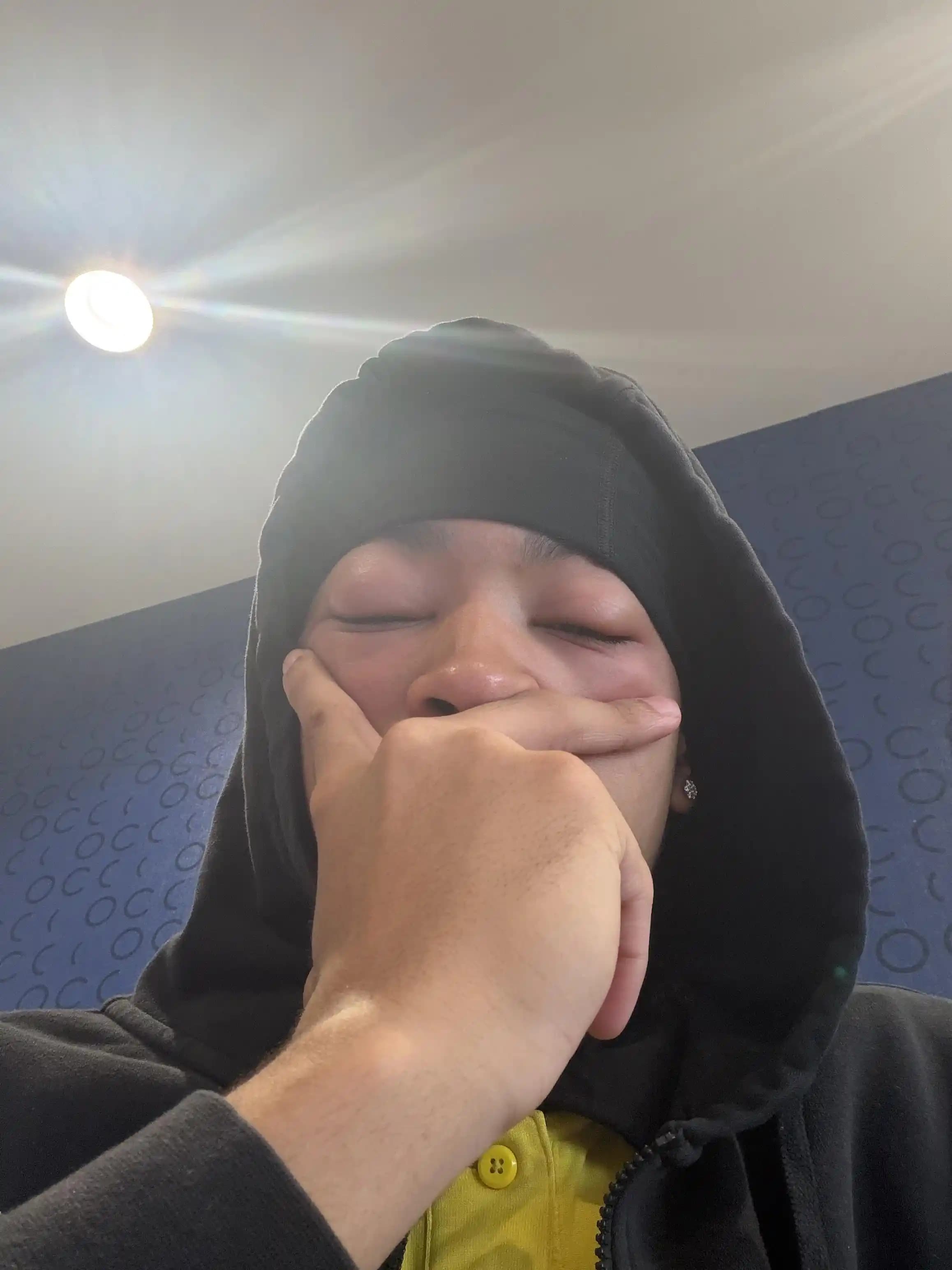 The Ordinary BHA Kimyasal Eksfoliantının Göz Çevresinde Alerjik Reaksiyon Riski ve Önlemleri