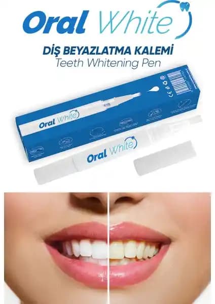 Oral White Cleaning Pro Diş Kalem ile Güvenli ve Hızlı Diş Beyazlatma Çözümü