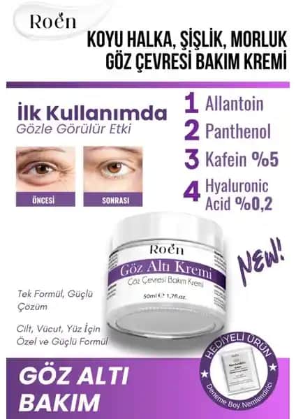 Roen Göz Altı Bakım Kremi: Morluklar, Şişlikler ve Nemlendirme İçin Etkili Çözüm