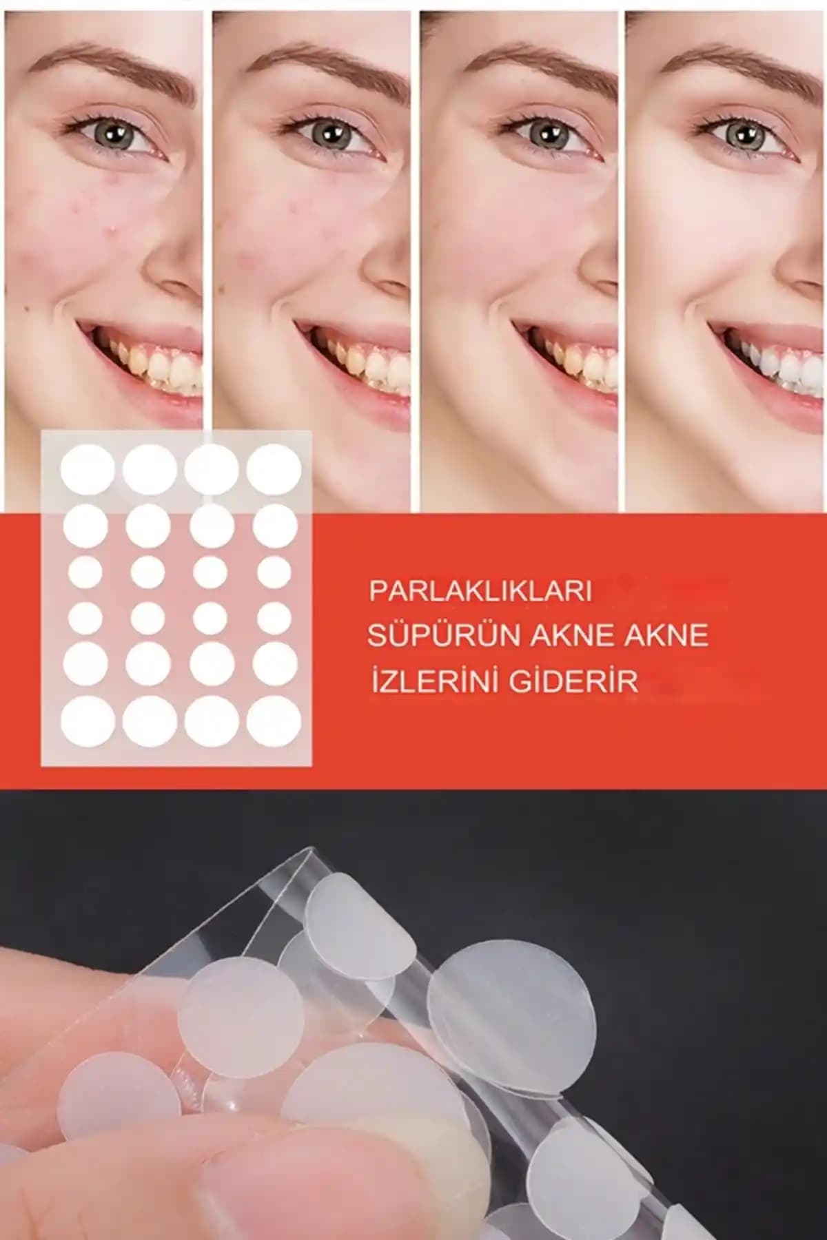 Akne Bantı Nedir ve Cilt Bakımında Nasıl Kullanılır Detaylı Rehber