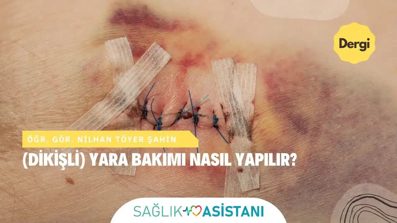 Dikişli Yaraların Tanımı, Bakımı ve Estetik Sonuçlar İçin En İyi Uygulamalar