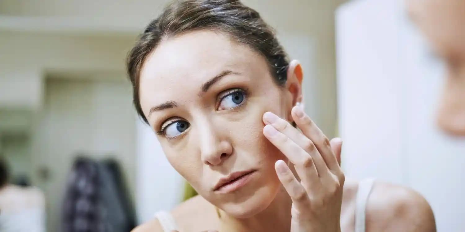 13 Yaşında Sivilceyle Mücadele ve Cilt Sağlığını Koruma Rehberi