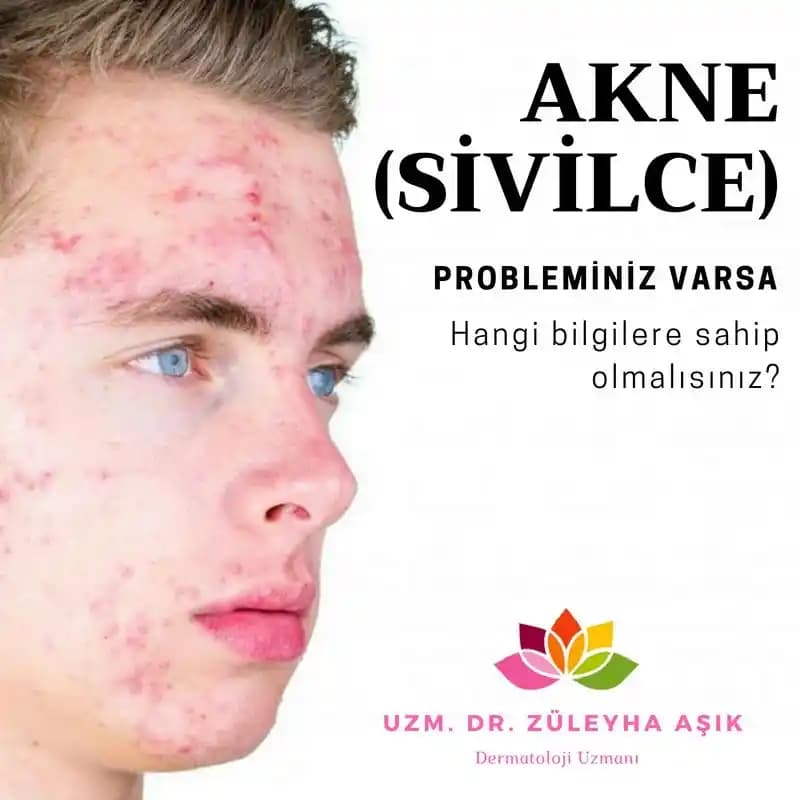 5 Yaşında Sivilce: Erken Dönemde Cilt Sağlığına Dair Bilinmesi Gerekenler ve Önlemler