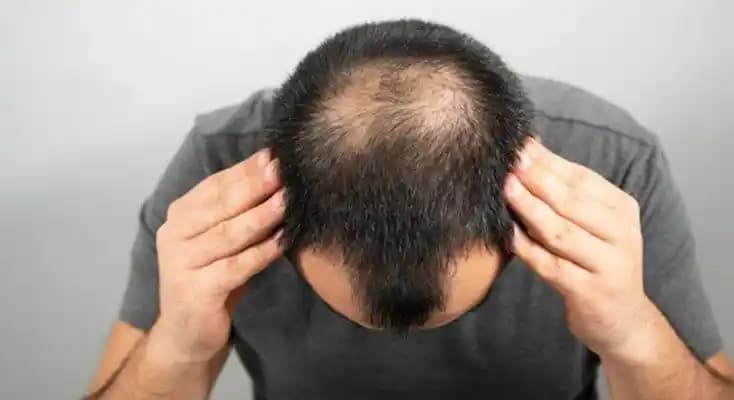 Adana'da Saç Ekimi Fiyatları ve Güvenilir Klinik Seçimi Rehberi