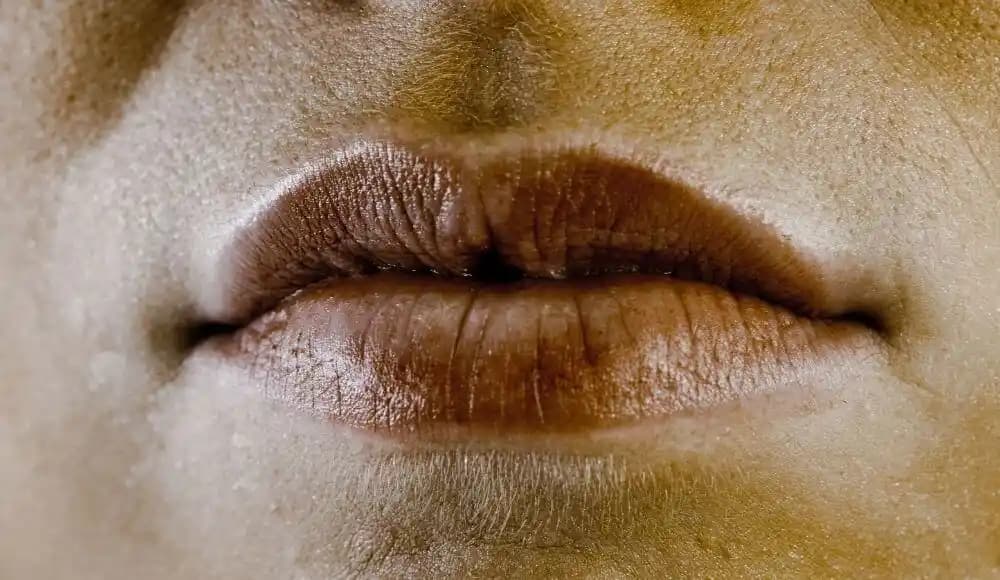 Ağız Kenarlarında Kararma Nedenleri ve Etkili Kozmetik Çözümler Rehberi