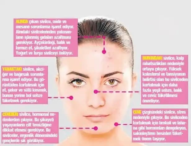 Alında Çıkan Sivilcelerin Nedenleri ve Etkili Çözüm Yolları