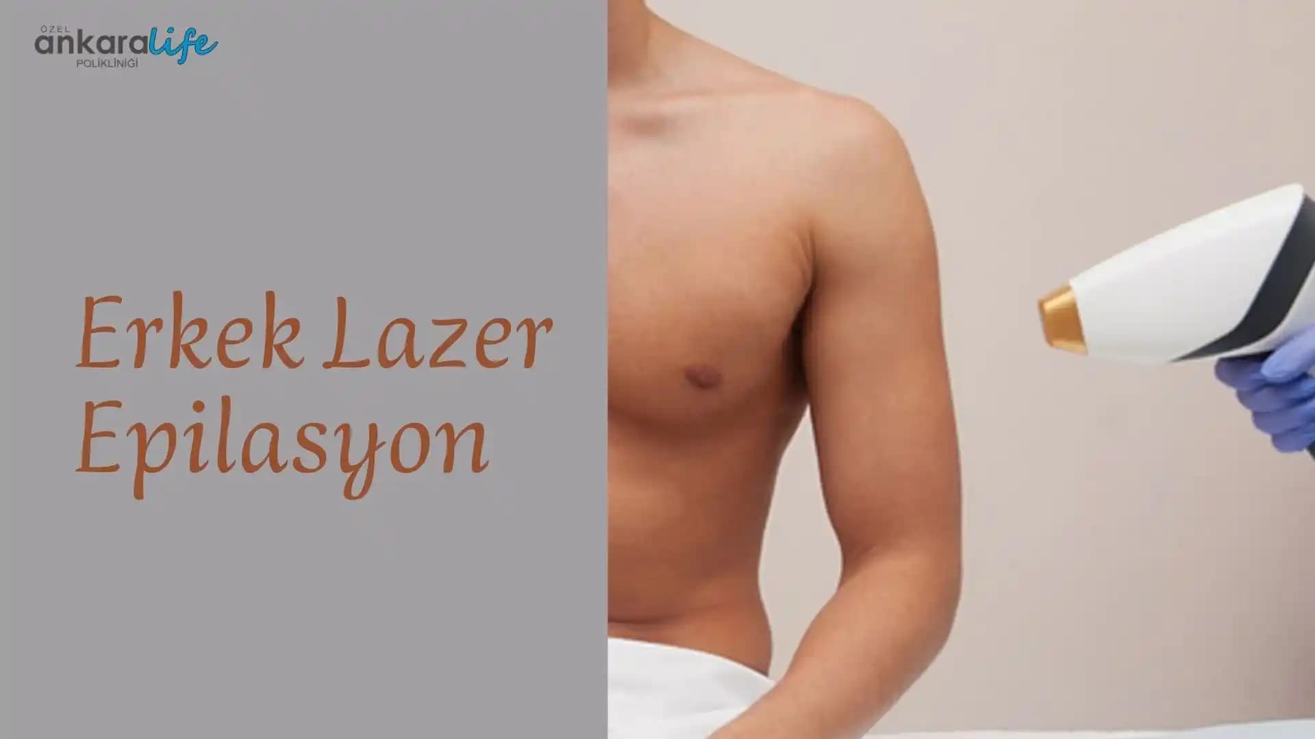 Ankara'da Erkekler İçin Epilasyon Rehberi: En İyi Yöntemler ve Klinikler Hakkında Bilgiler
