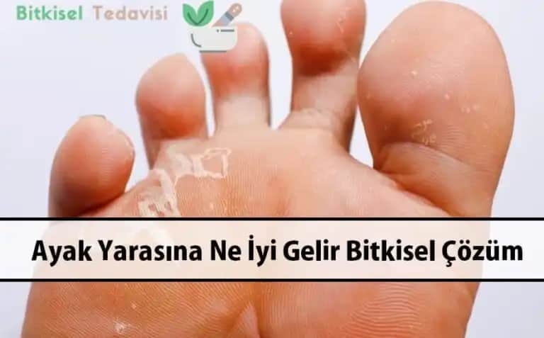 Ayak Altı Yaralarının Nedenleri ve Doğru Tedavi Yöntemleri
