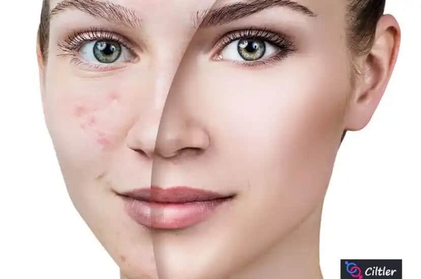 Ayak Altında Çıkan Sivilceler: Nedenleri, Belirtileri ve Etkili Çözüm Yolları