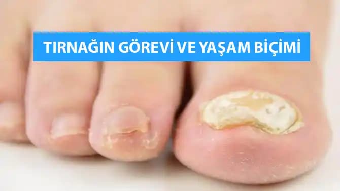 Ayak Tırnağı Kırılması ve Koruma Yöntemleri: Sağlıklı ve Güzel Tırnaklar İçin Rehber