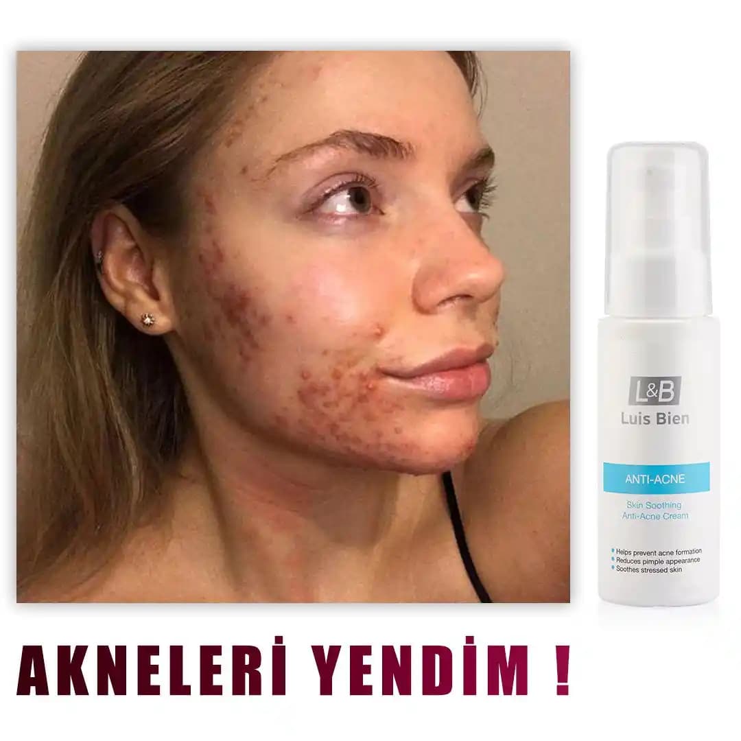 B3 Vitamini İçeren Kremler: Cilt Sağlığını Destekleyen Etkili Bakım Ürünleri