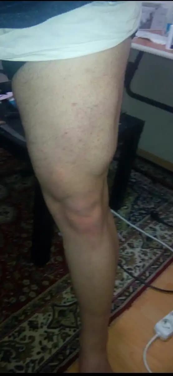 Bacak Kılları: Farklı Yöntemler ve Bakım İpuçlarıyla Pürüzsüz Bacaklara Ulaşın