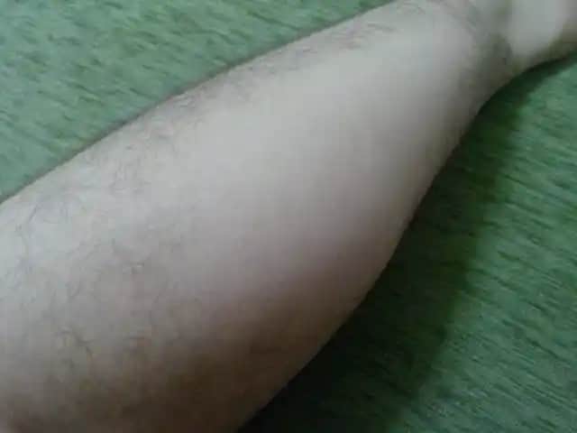 Bacak Kıllarının Dökülme Nedenleri ve Etkili Çözüm Yolları Hakkında Detaylı Bilgi