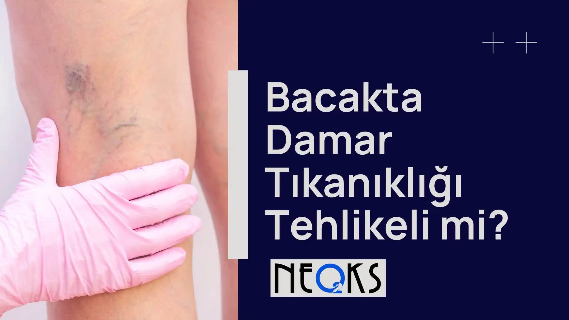 Bacakta Çatlak Belirtileri, Nedenleri ve Etkili Tedavi Yöntemleri