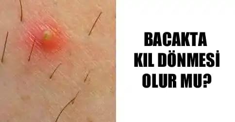 Bacakta Kıl Batması Nedenleri, Belirtileri ve Etkili Çözüm Yöntemleri