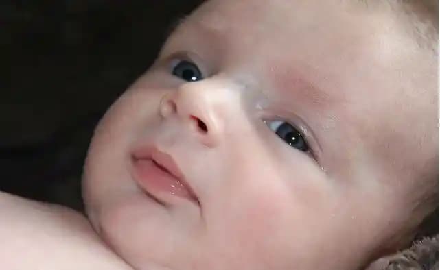 Bebeklerde Beyaz Lekelerin Nedenleri ve Doğru Cilt Bakım Yöntemleri