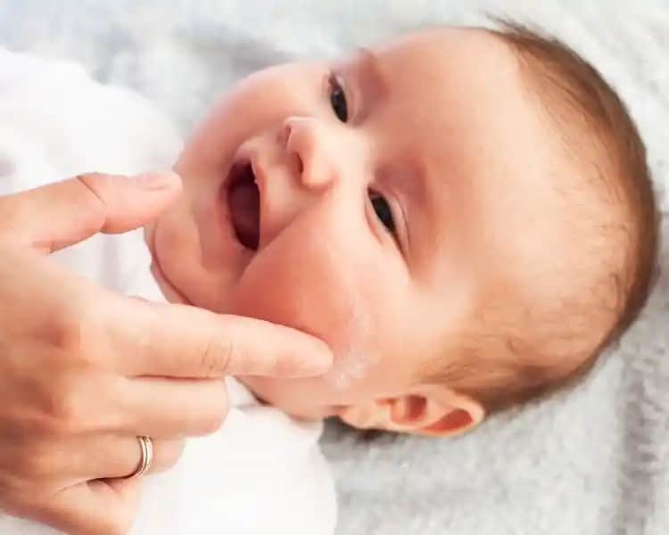 Bebeklerde Egzama ve Kozmetik Yaklaşımlarla Çözüm Yolları