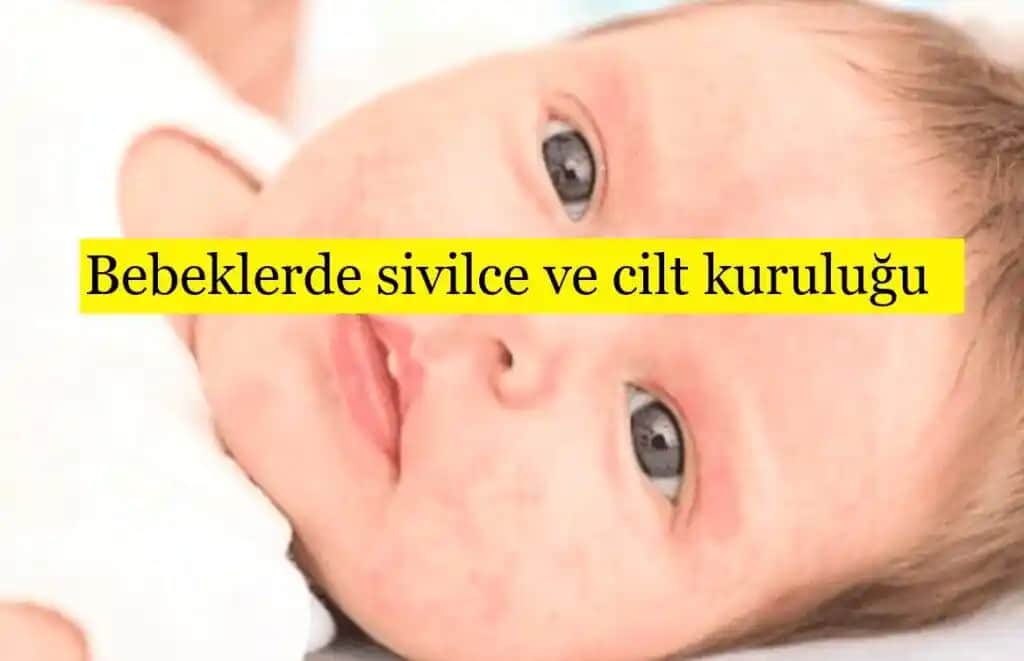 Bebeklerde Yüz Kuruluğu Nedenleri Belirtileri ve Etkili Bakım Yöntemleri