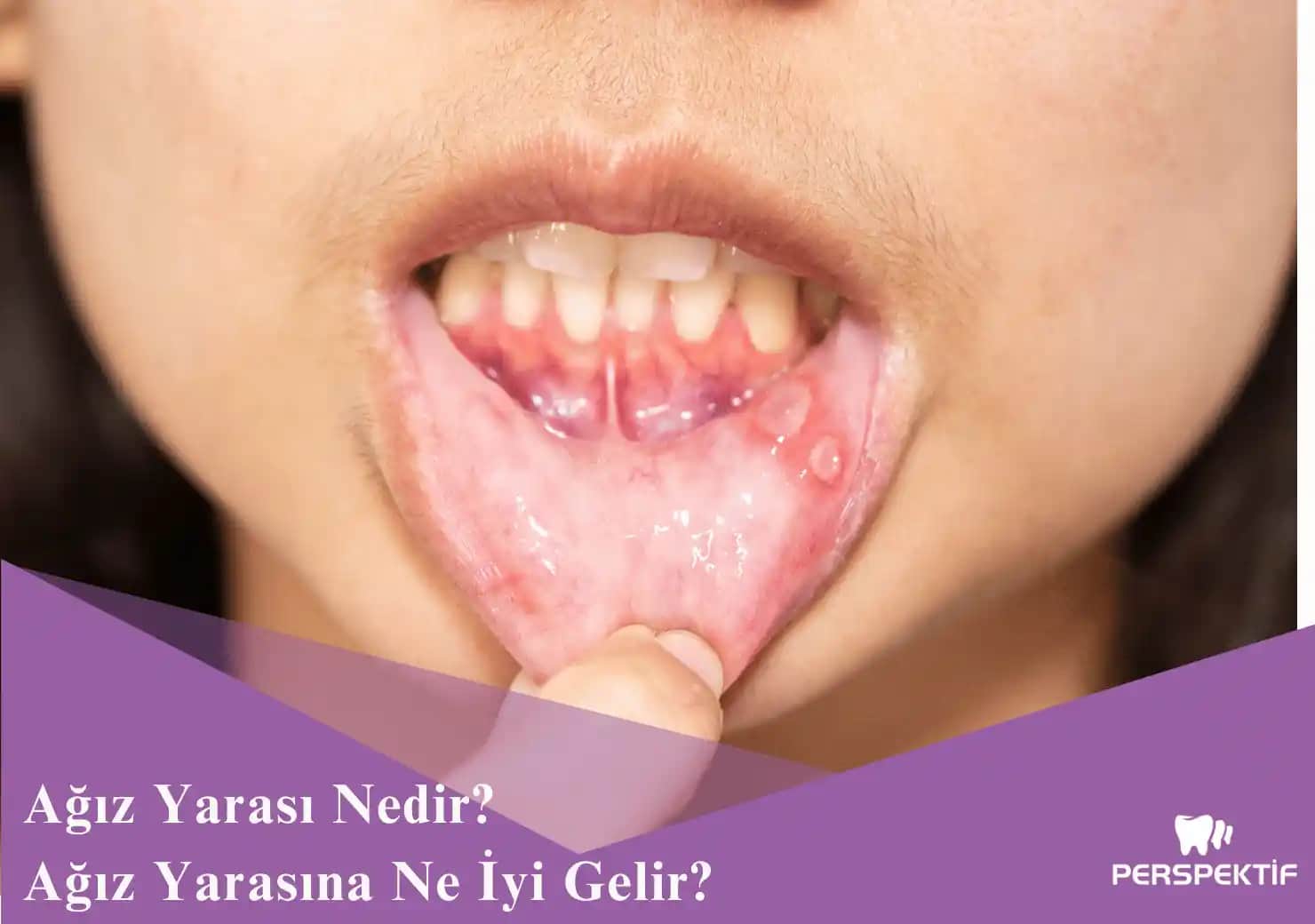 Bıçak Yaralarına Ne İyi Gelir? Doğru İlk Yardım ve Doğal Çözümler