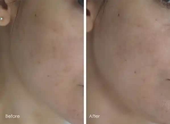 Bioderma Pigmentbio Sensitive Areas Ürünü Kullanımı ve Etkileri Üzerine Detaylı İnceleme