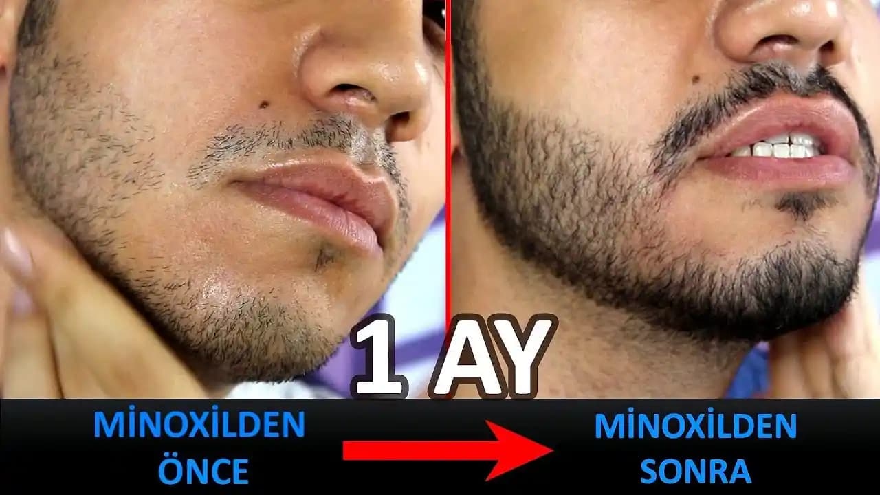 Bir Aylık Sakal Bakımı ve Gelişimi İçin En İyi İpuçları ve Tavsiyeler