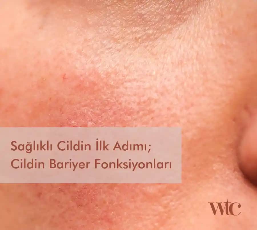 Bozuk Cilt Bariyerini Onarma ve Sağlıklı Cilt İçin Temel Adımlar