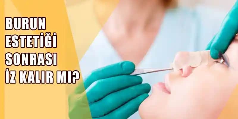 Burun Estetiği Sonrası Dikiş İzi İçin En İyi Krem Rehberi ve Bakım Tavsiyeleri