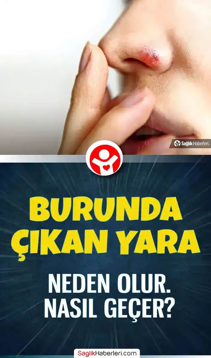 Burun Üstündeki Yara Nasıl Geçer: Etkili Tedavi ve Bakım Yöntemleri