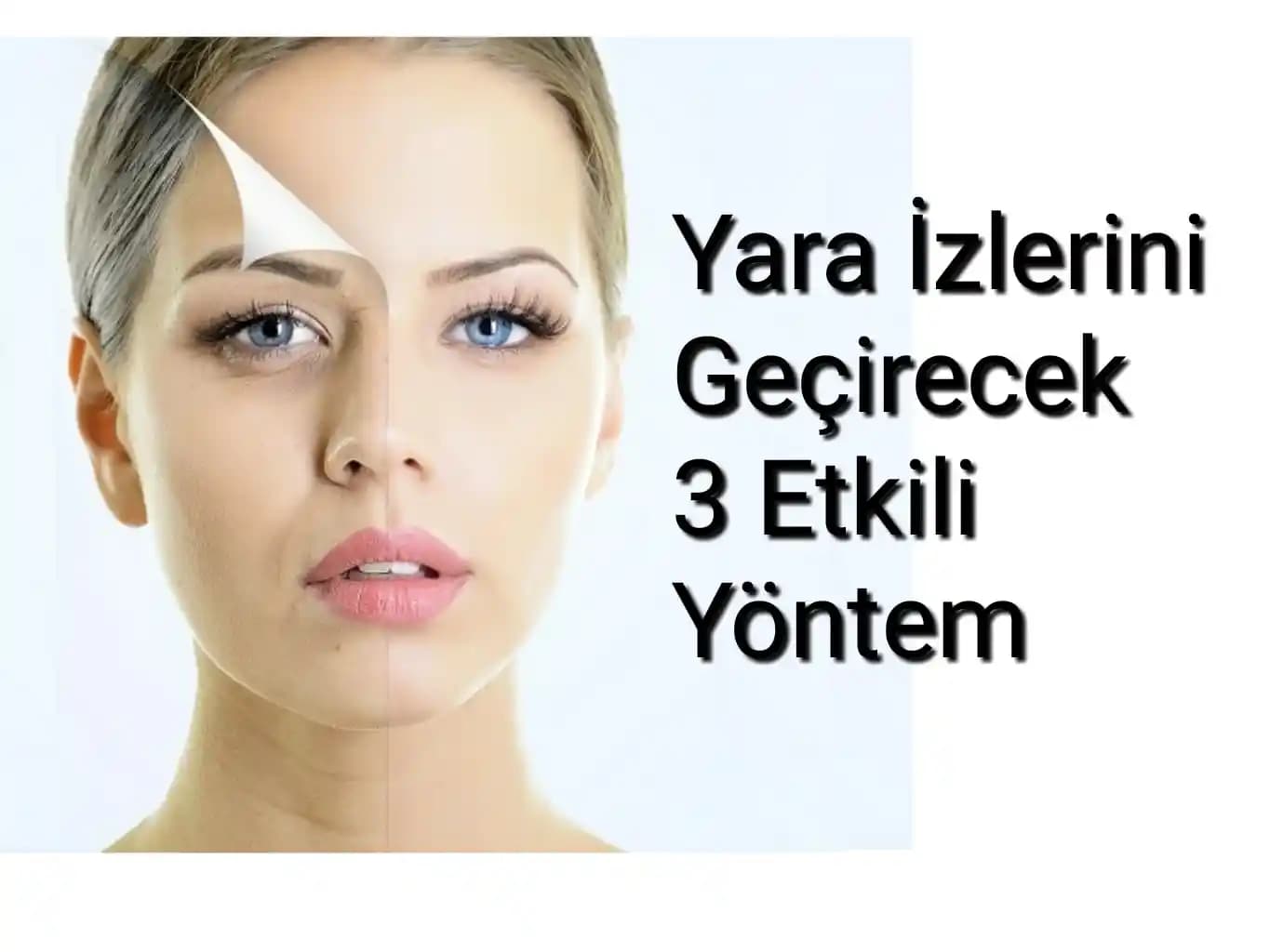 Burunda Yara İzi Nasıl Geçer En Etkili Yöntemler ve Uzman Tavsiyeleri