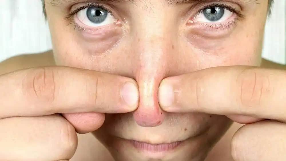 Burundaki Siyah Noktaların Nedenleri ve Etkili Temizleme Yöntemleri