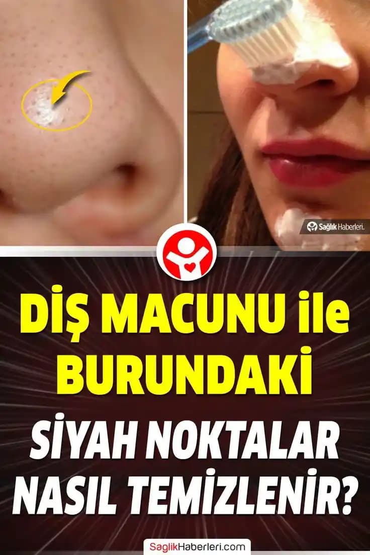 Burundaki Yağları Temizleme Yöntemleri ve Cilt Sağlığını Korumak İçin Tavsiyeler