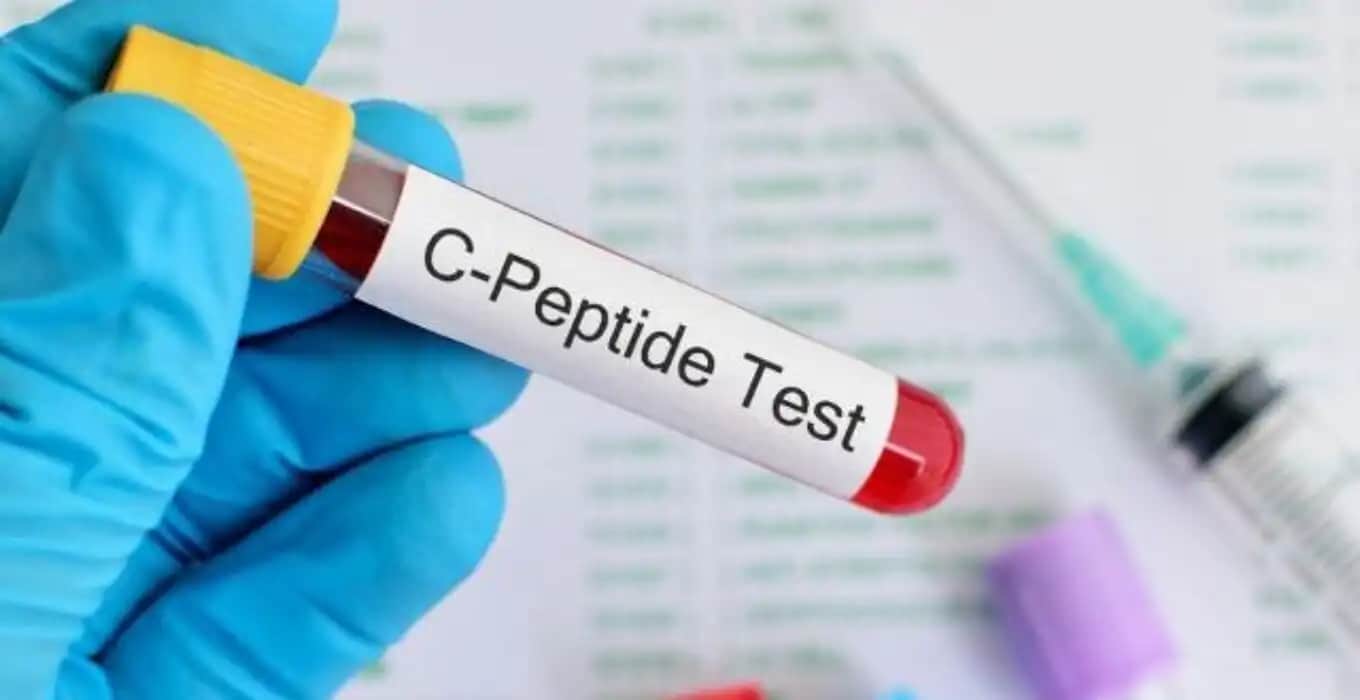 C Peptit Nedir ve Sağlıklı Seviyelerini Koruma Yolları Hakkında Bilgi