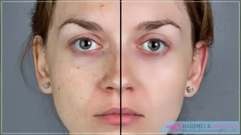 Çiller Nedir? Nedenleri ve Çillerle Başa Çıkma Yöntemleri Hakkında Bilgiler