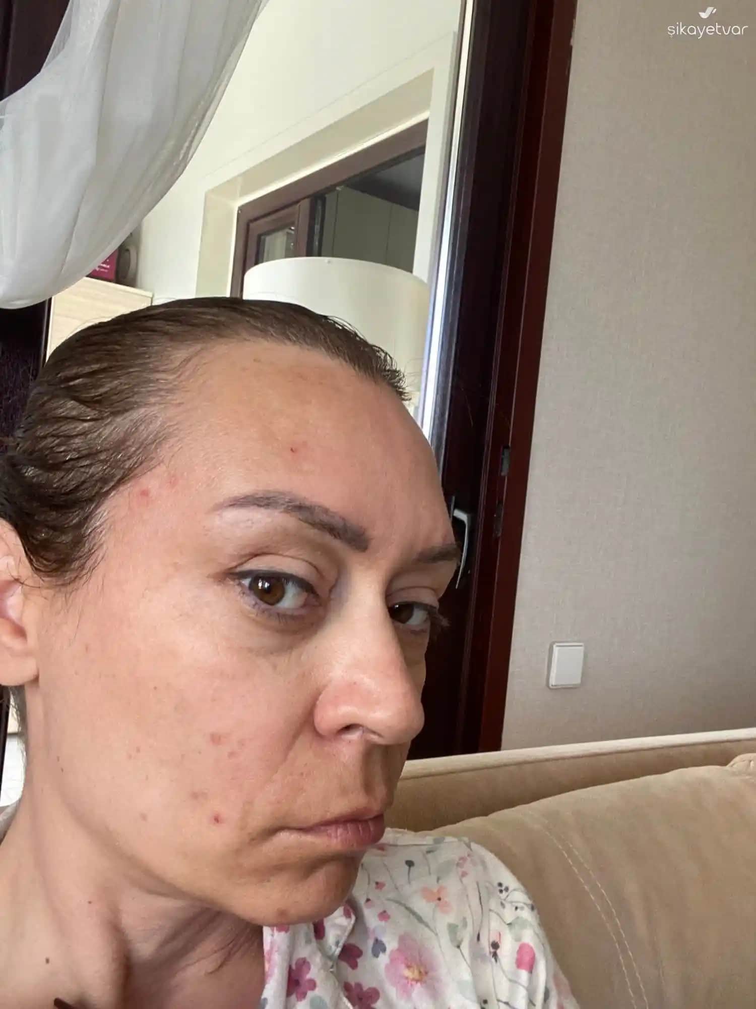 Cilt Bakımı Sonrası Yaraların Özellikleri ve Sağlıklı İyileşme Yöntemleri