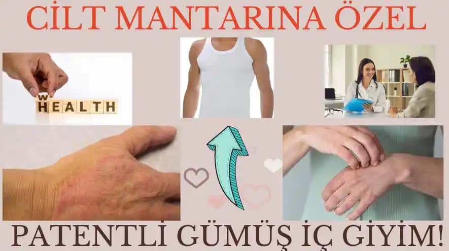 Cilt Mantarı Tedavisinde Doğal Yöntemler ve En Etkili Bitkisel Çözümler
