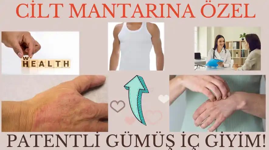 Cilt Mantarı Tedavisinde Doğal Yöntemler ve En Etkili Bitkisel Çözümler