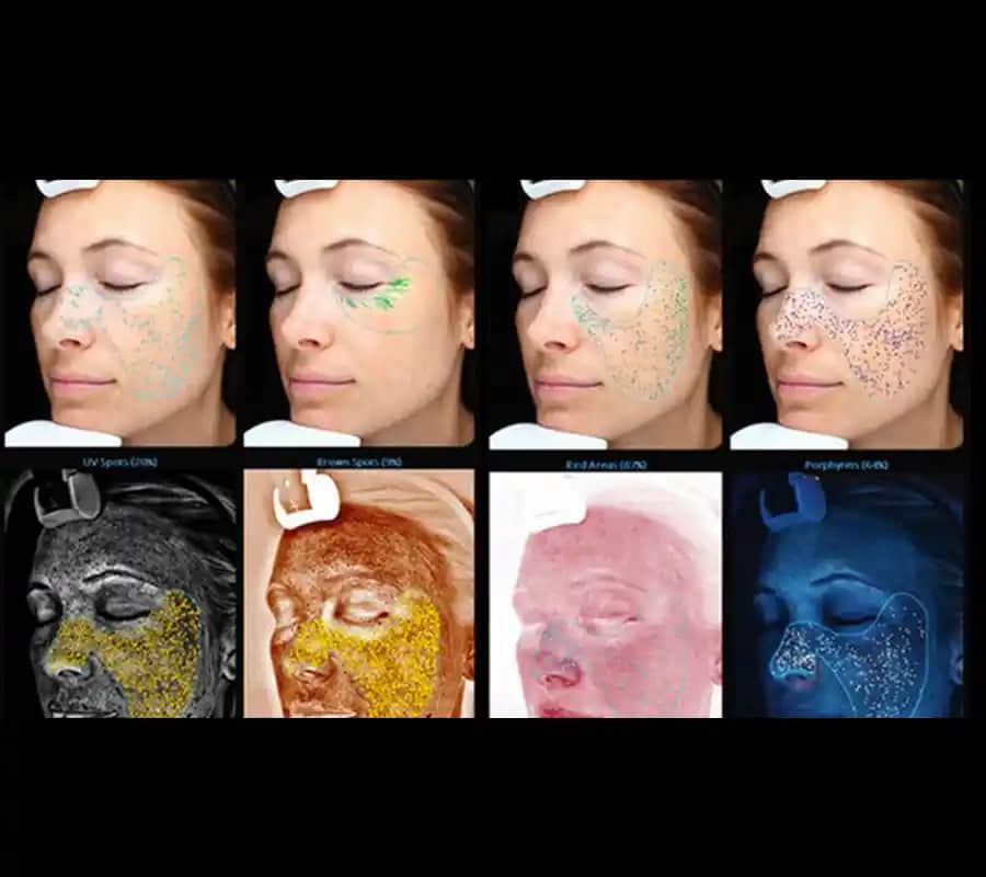 Cilt Renk Analizi ile Doğru Makyaj ve Renk Seçimi Yöntemleri