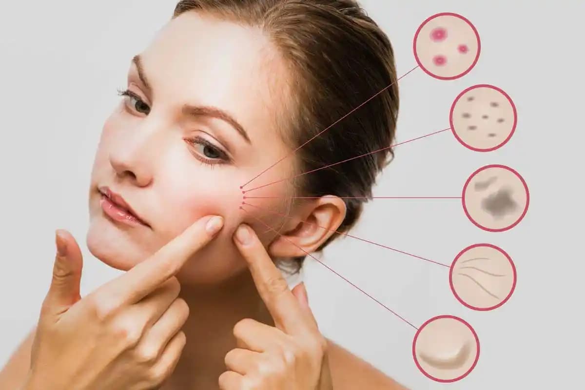 Cilt Sağlığını Koruma ve Geliştirme Yöntemleri: Temel Bilgiler ve İpuçları