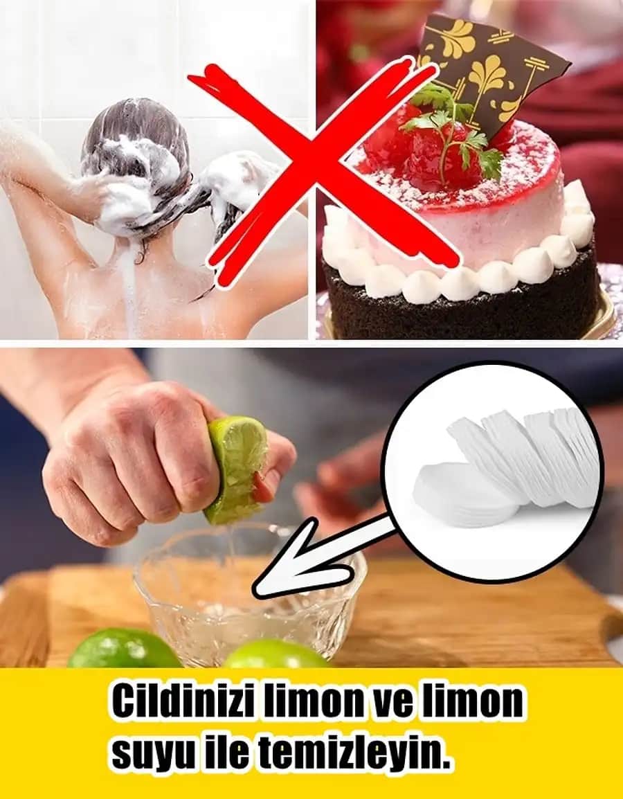 Ciltte Akne Nedenleri, Türleri ve Etkili Çözüm Yolları Hakkında Kapsamlı Bilgi