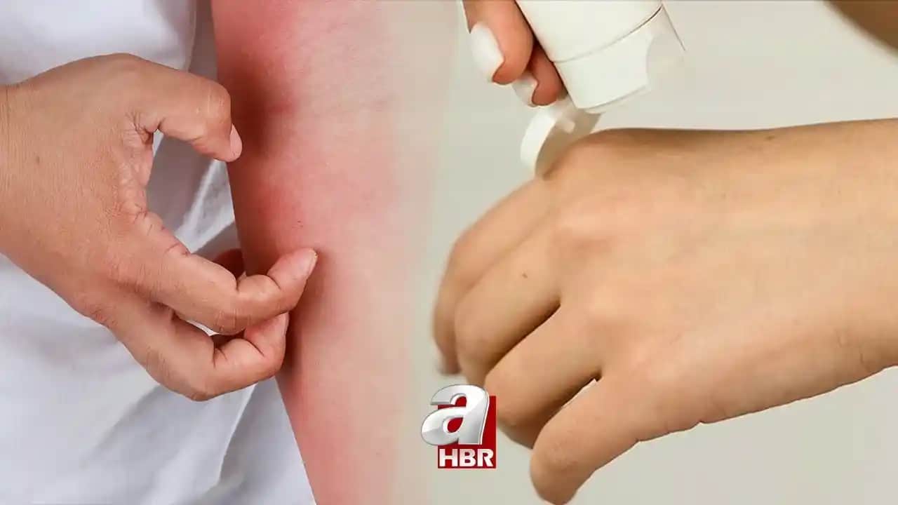 Ciltte Geçmeyen Kızarıklık Nedenleri ve Etkili Tedavi Yöntemleri